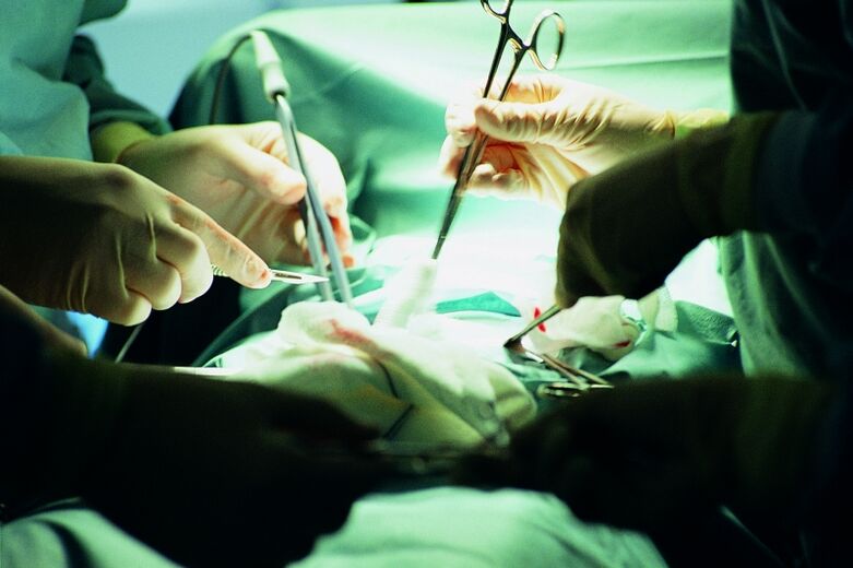 augmentation chirurgicale de l'épaisseur du pénis